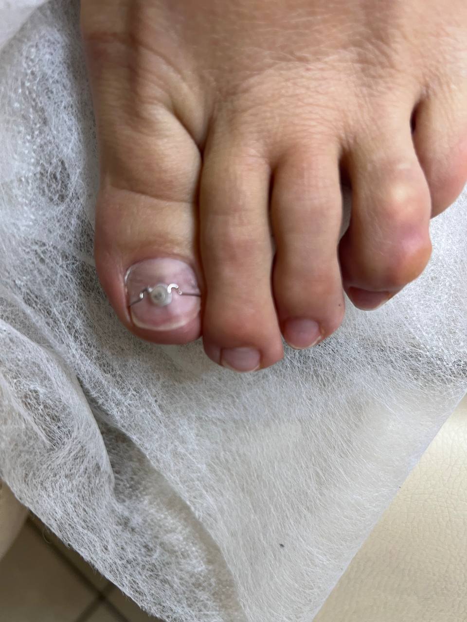 Титановa нитка 3ТО на нігті